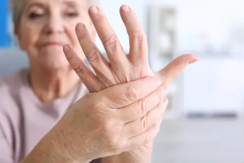 RA patient